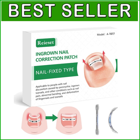 Advanced Ingrown Toenail Treatment Kit – Titanium Alloy Solution for All Nails