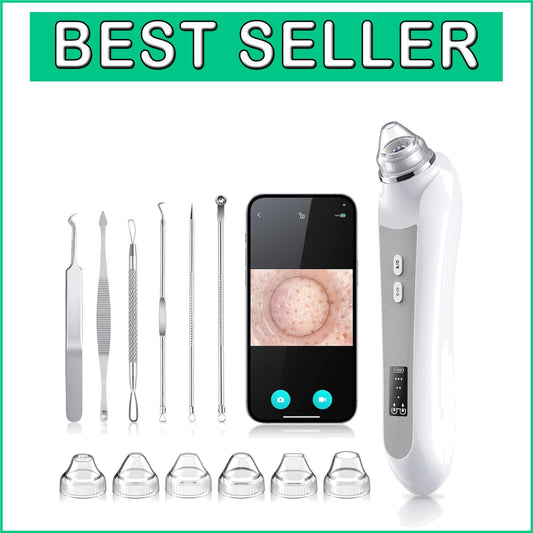 Premium Blackhead Remover Tool - 1080P Camera & LED Light for All Skin Types