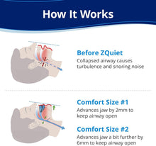 Load image into Gallery viewer, Anti-Snoring Mouthpiece Starter Pack, 2 Sizes for Comfort &amp; Easy Breathing
