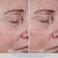 Load image into Gallery viewer, Obagi ELASTIderm Non-Injectable Filler 0.68 oz - Reduces Fine Lines Effortlessly