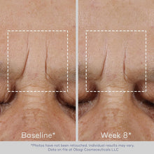 Load image into Gallery viewer, Obagi ELASTIderm Non-Injectable Filler 0.68 oz - Reduces Fine Lines Effortlessly