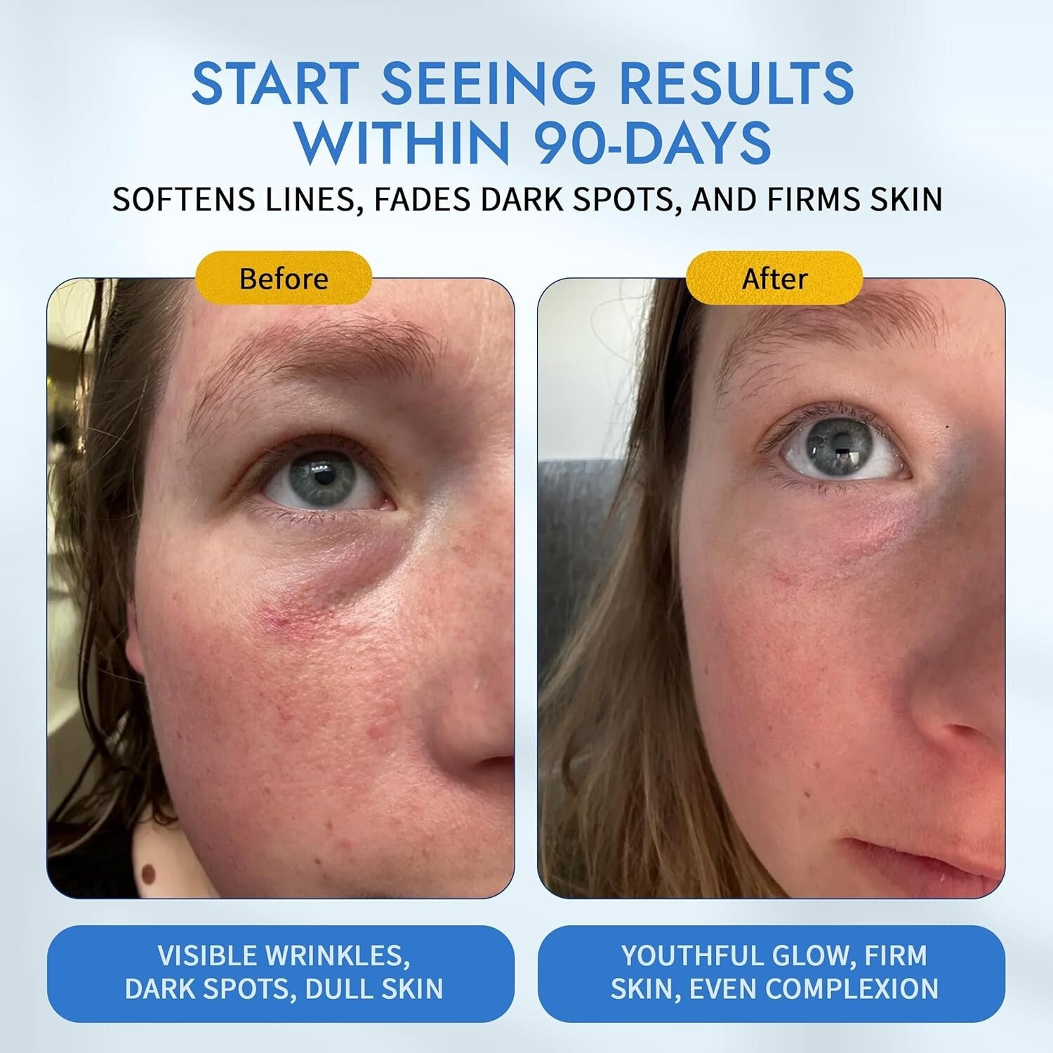 Moonlight Retinal Super Serum - 10X More Potent, Anti-Wrinkle & Dark Spot Care