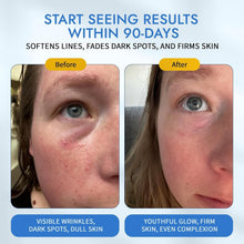 Load image into Gallery viewer, Moonlight Retinal Super Serum - 10X More Potent, Anti-Wrinkle &amp; Dark Spot Care