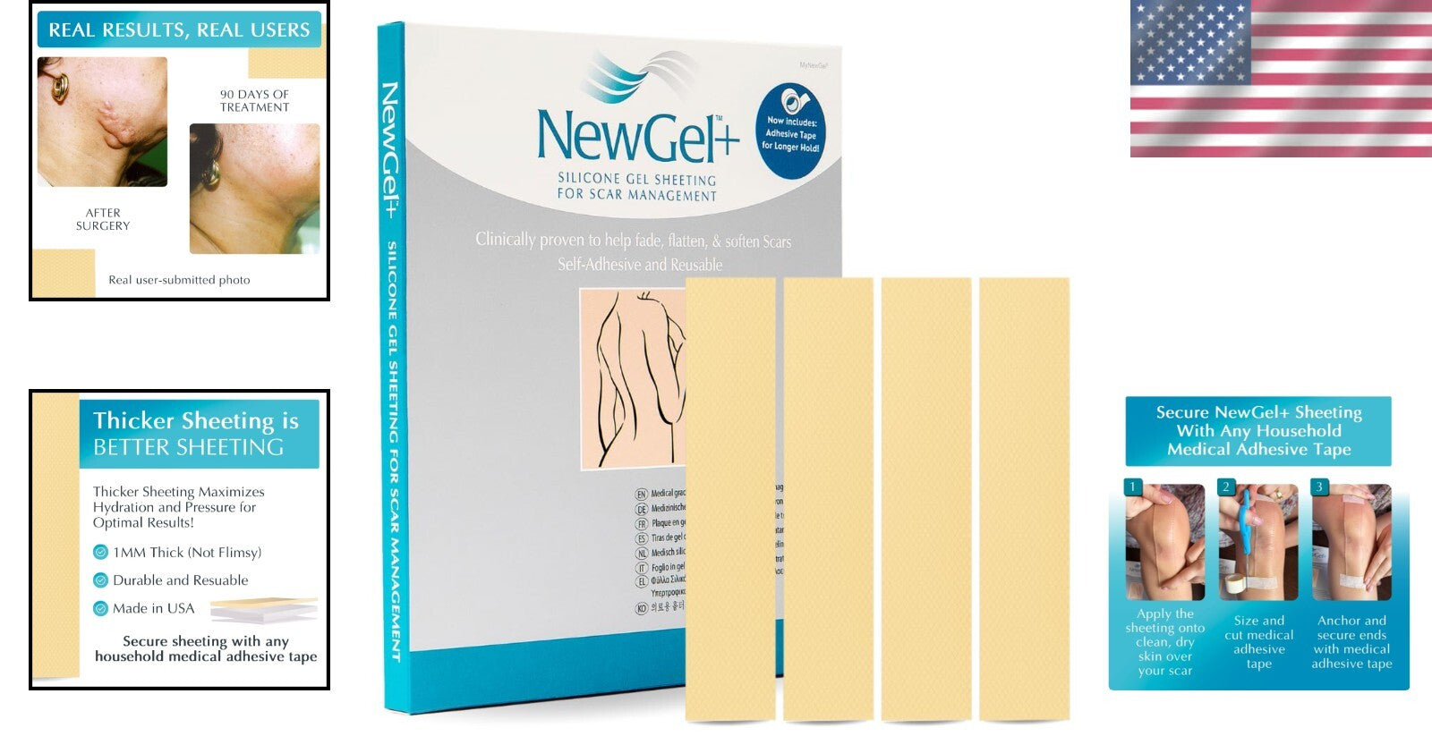 NewGel Plus 1" x 6" Silicone Scar Sheets - Effective for Old and New Scars