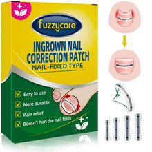 Load image into Gallery viewer, Ingrown Toenail Correction Kit - 10 Titanium Alloy Tools for Fast Pain Relief