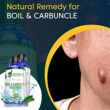 Load image into Gallery viewer, Fast-Acting Natural Remedy for Boils &amp; Carbuncles - Safe &amp; Gentle 25g Pellets
