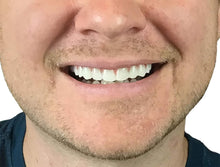 Load image into Gallery viewer, Re-moldable Ultra-thin Comfort Flex Veneers - Fix Your Smile in Minutes