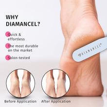 Load image into Gallery viewer, Professional-Grade Diamond Foot Buffer - Effortless Coarse Grit for Calluses
