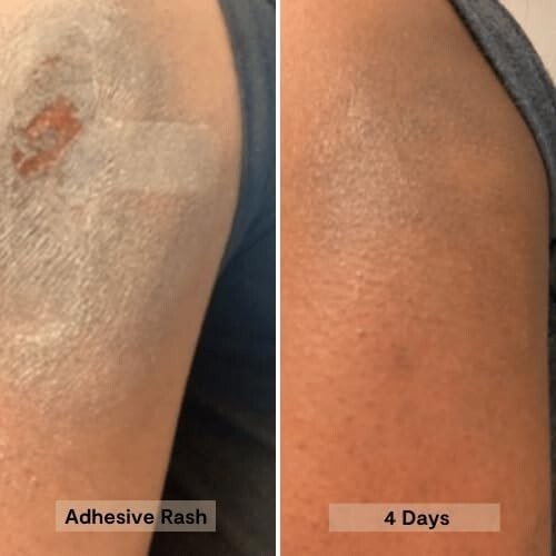 Cooling Body Butter with Manuka Honey for Sensitive Skin - 4 oz Hydrating Salve