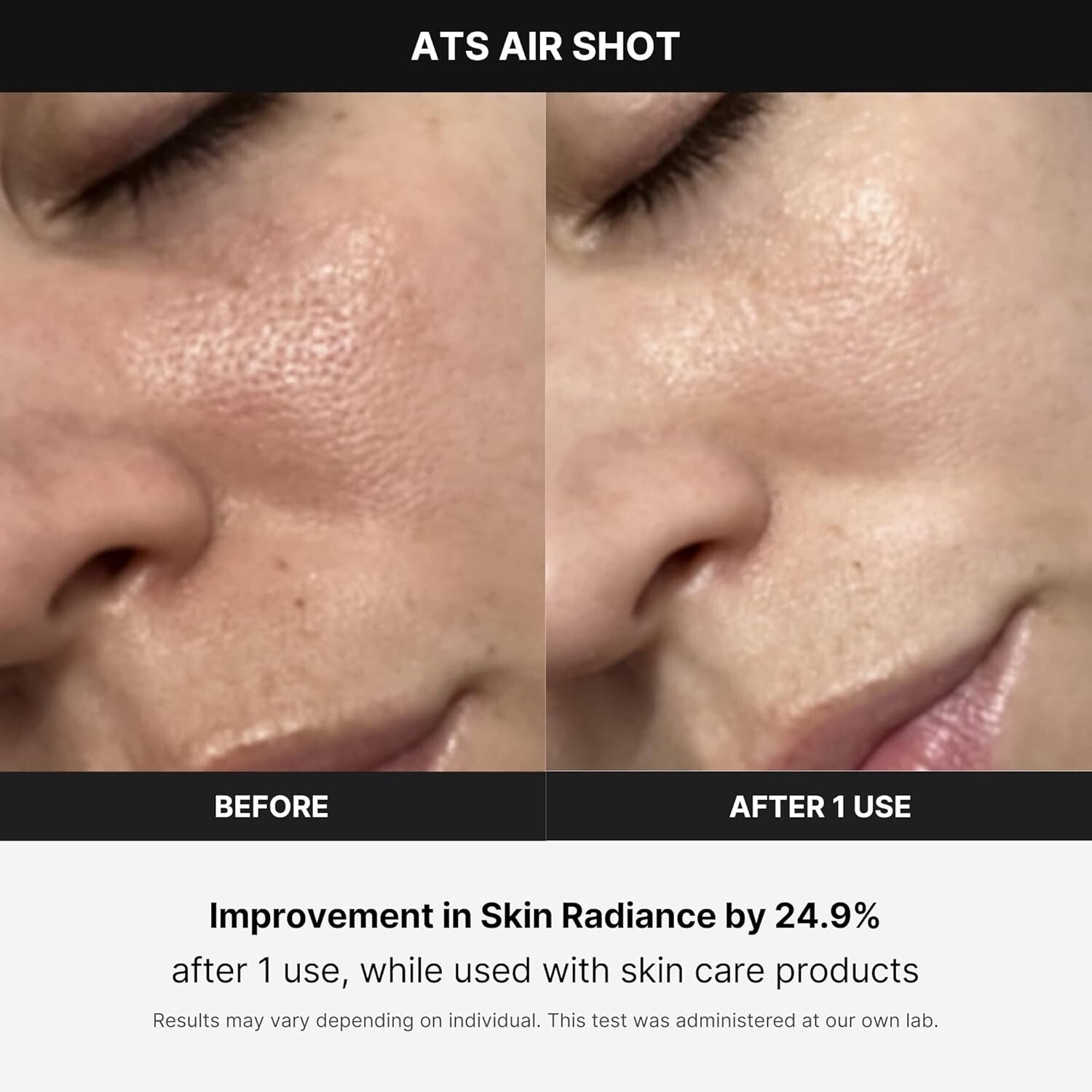 Microneedling Skin Care Device - Age-R ATS Air Shot for Exfoliation & Pore Ti...