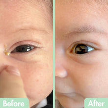 Load image into Gallery viewer, Gentle Kids Eyelid Cleanser Spray - Safe, Non-Toxic Eye Drops for Children