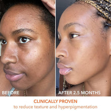 Load image into Gallery viewer, Dr. Dennis Gross Peel Pads - Fast-Acting 2-Step Treatment for Flawless Skin