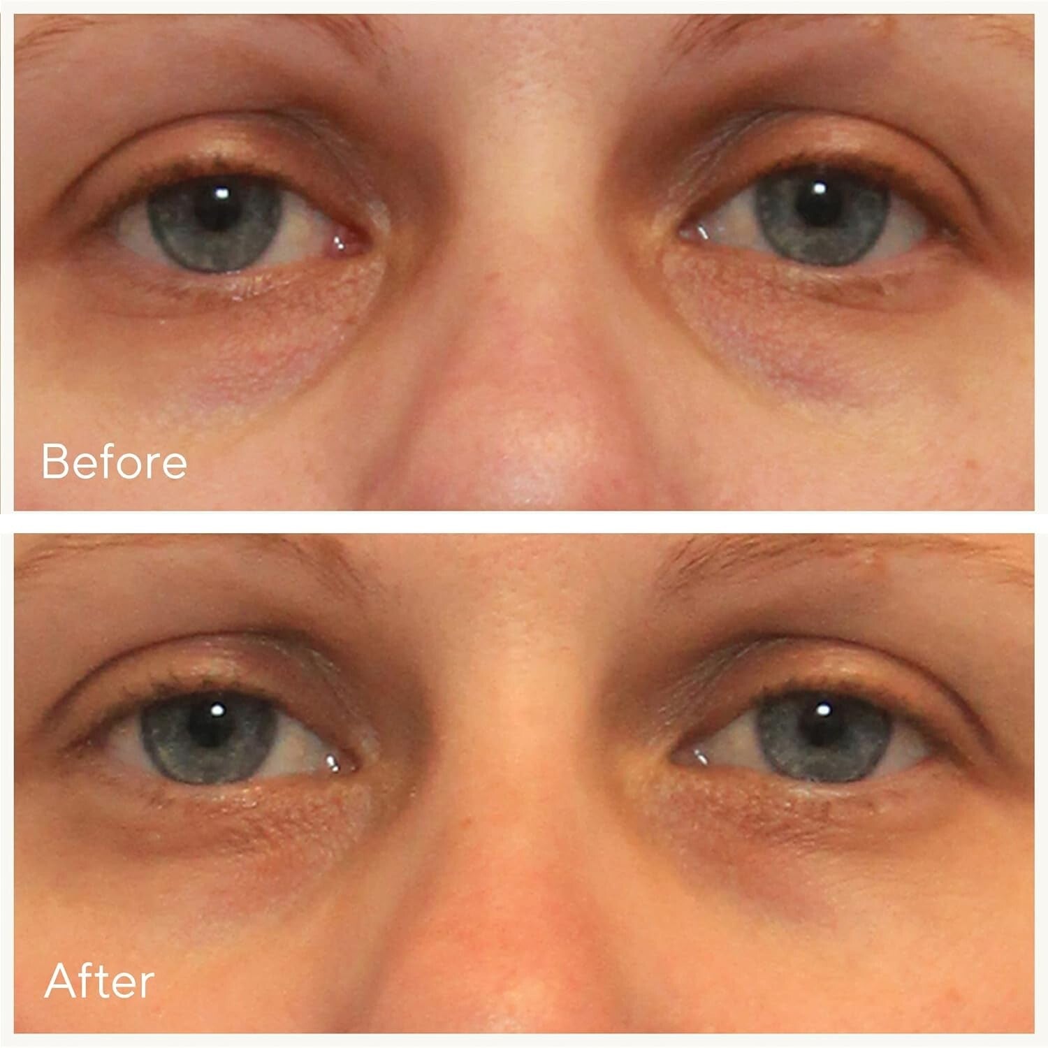 Brightening Dark Circle Corrector with Antioxidants and Cooling Cucumber Effect