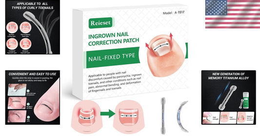 Titanium Alloy Ingrown Toenail Treatment Kit – Patented Nail Correction Tools