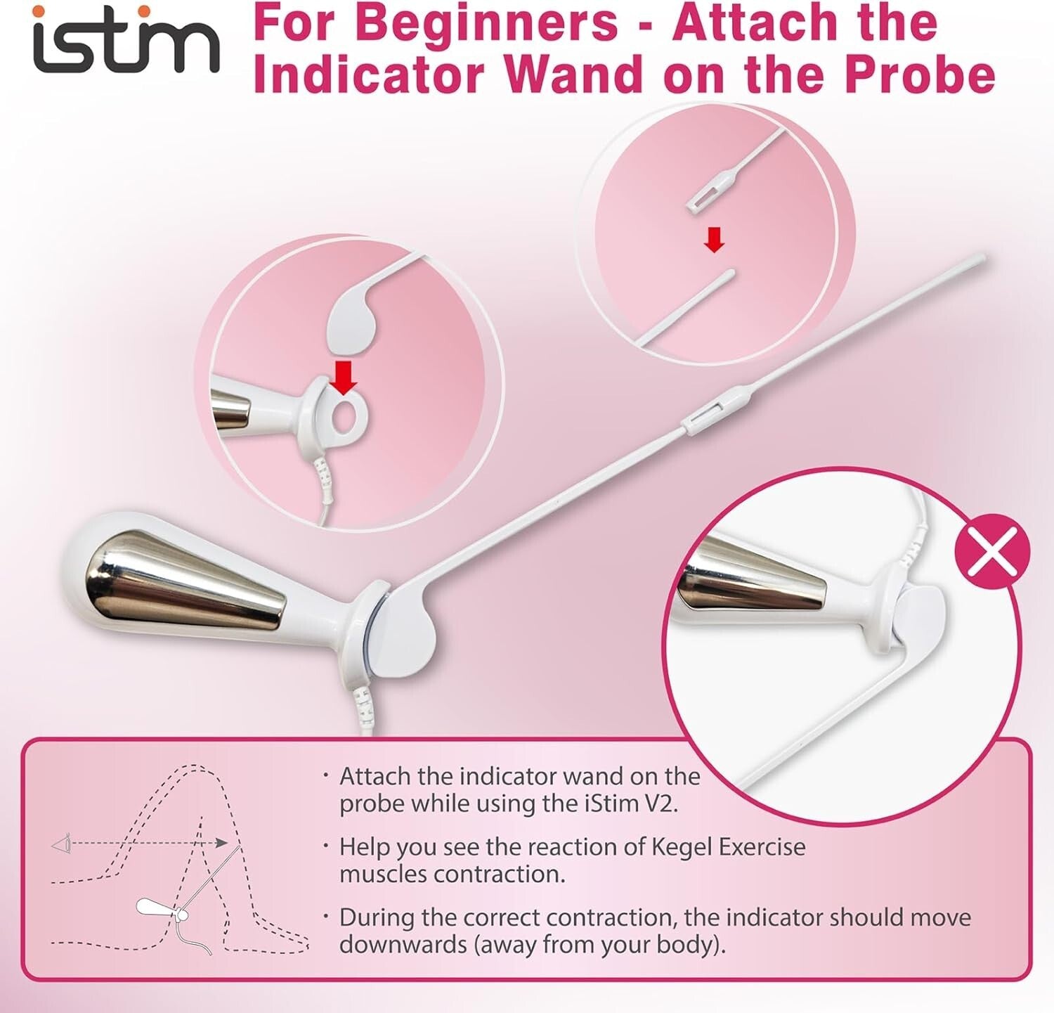 Kegel Exerciser & Incontinence Stimulator with Probe for Women’s Bladder Control