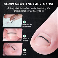Load image into Gallery viewer, Compact &amp; Effective Ingrown Toenail Treatment - Titanium Alloy Correction Tools