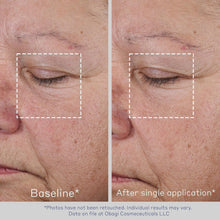 Load image into Gallery viewer, Obagi ELASTIderm Non-Injectable Filler 0.68 oz - Reduces Fine Lines Effortlessly
