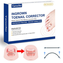 Load image into Gallery viewer, Nitinol Ingrown Toenail Corrector Kit - Fast Relief &amp; Shape Change in 30 Days