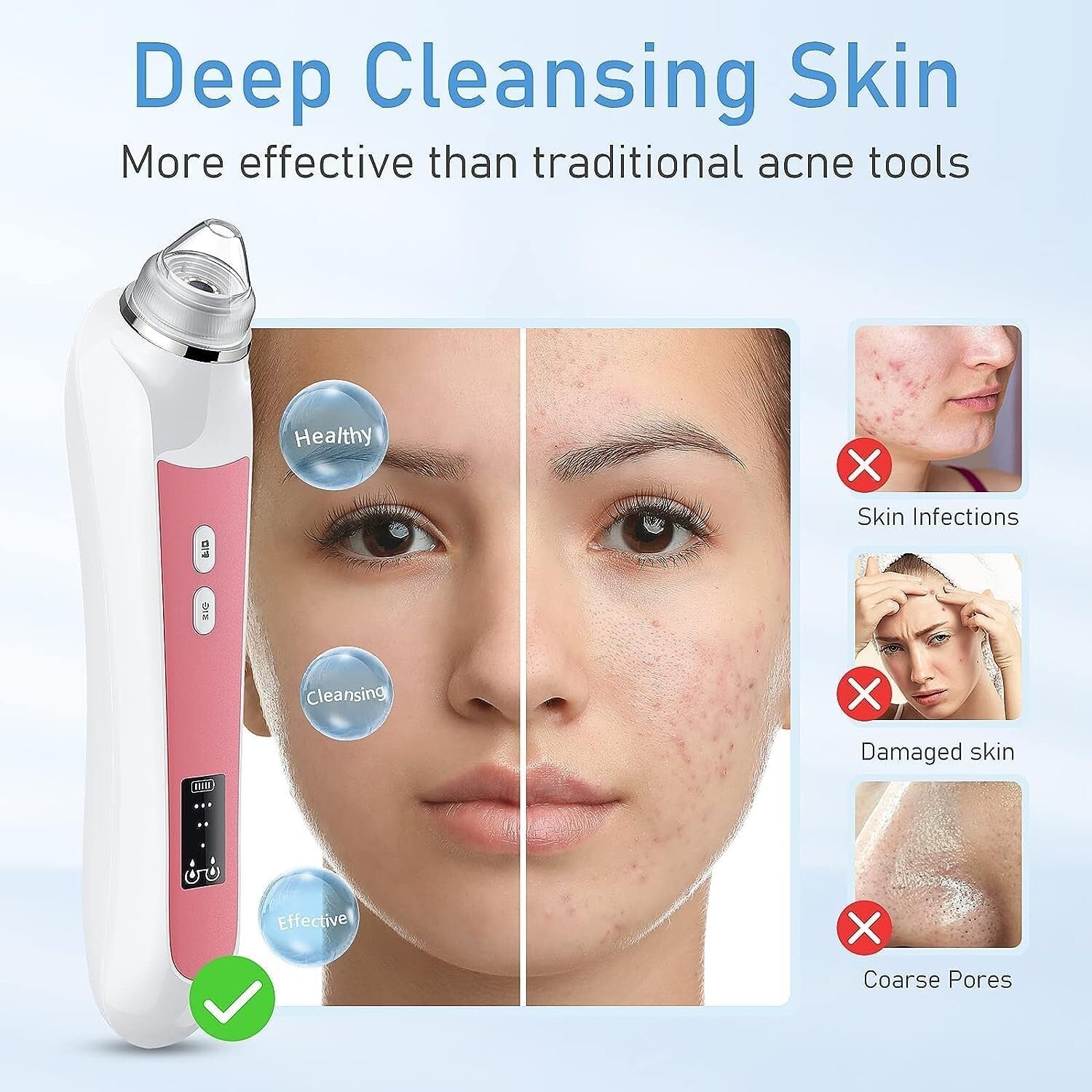 Advanced Pore Vacuum with Integrated Camera - Portable Blackhead Removal Tool