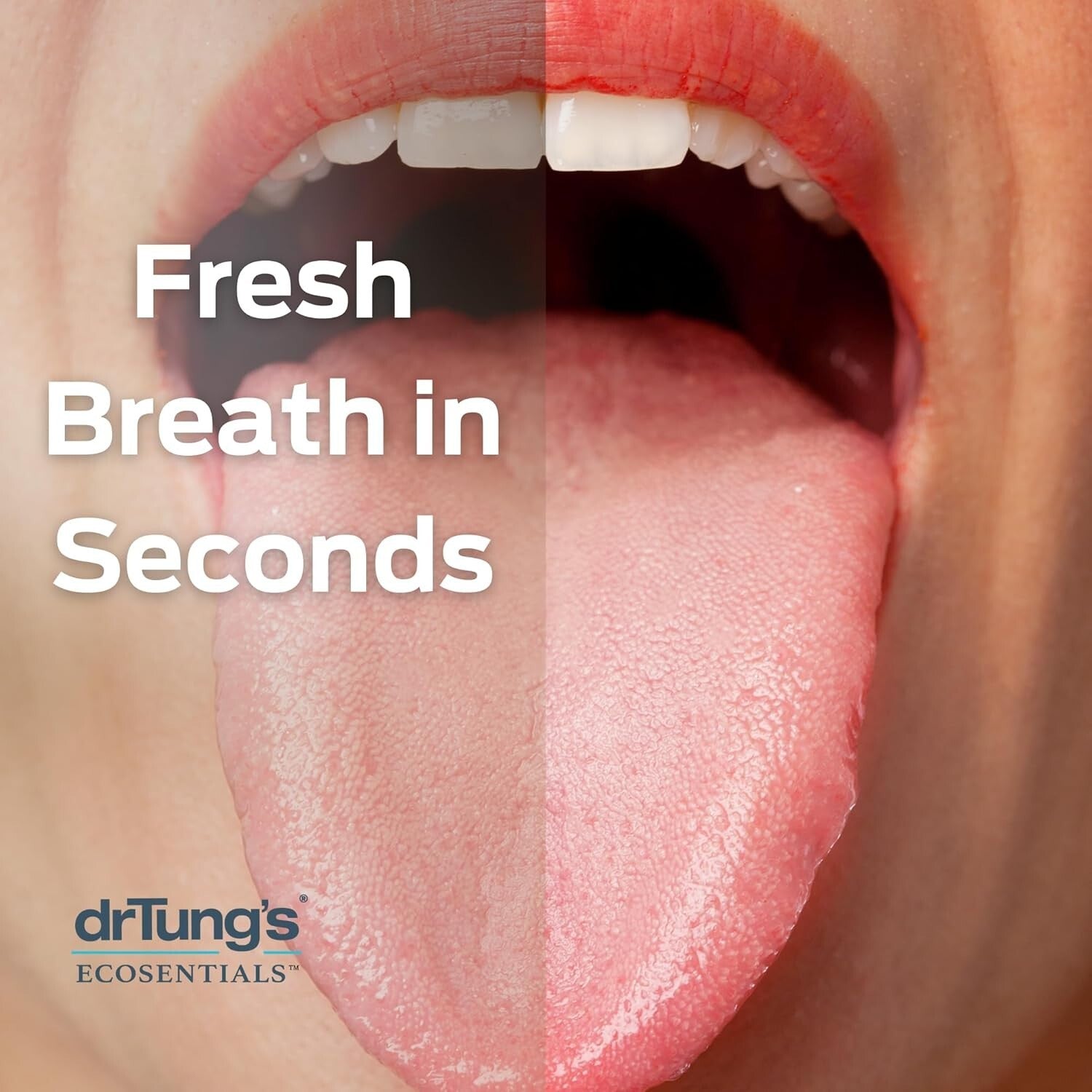 12-Pack Stainless Steel Tongue Scraper with Comfort Grip - Fresh Breath Solution