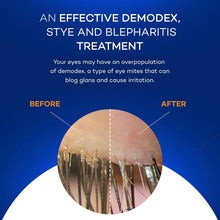 Load image into Gallery viewer, Moisturizing Eyelid Wipes for Blepharitis Relief - Natural and Travel-Friendly