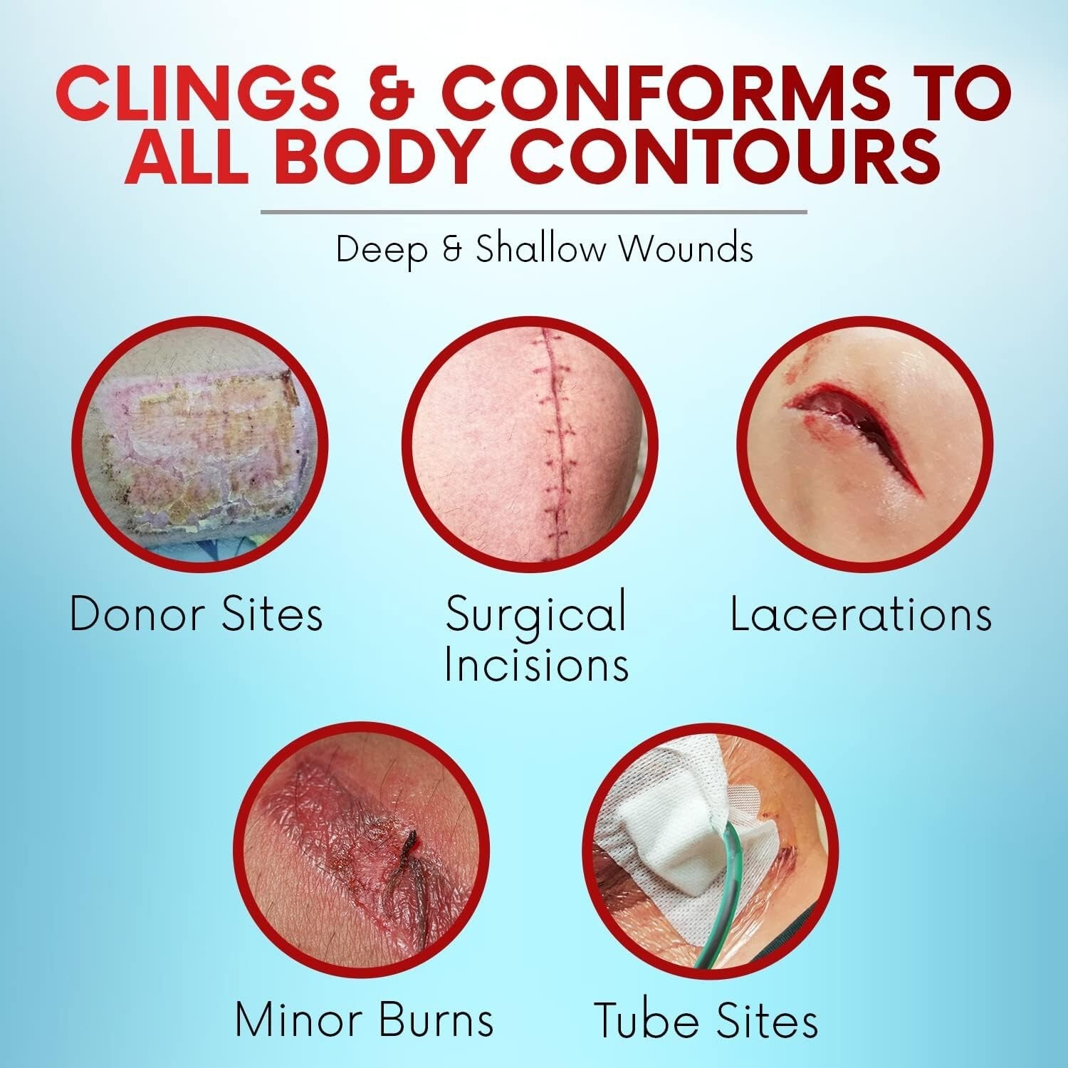 Xeroform Petrolatum Dressing 5x9 - Non-Adherent Sterile Wound Care Pads (50 ct)