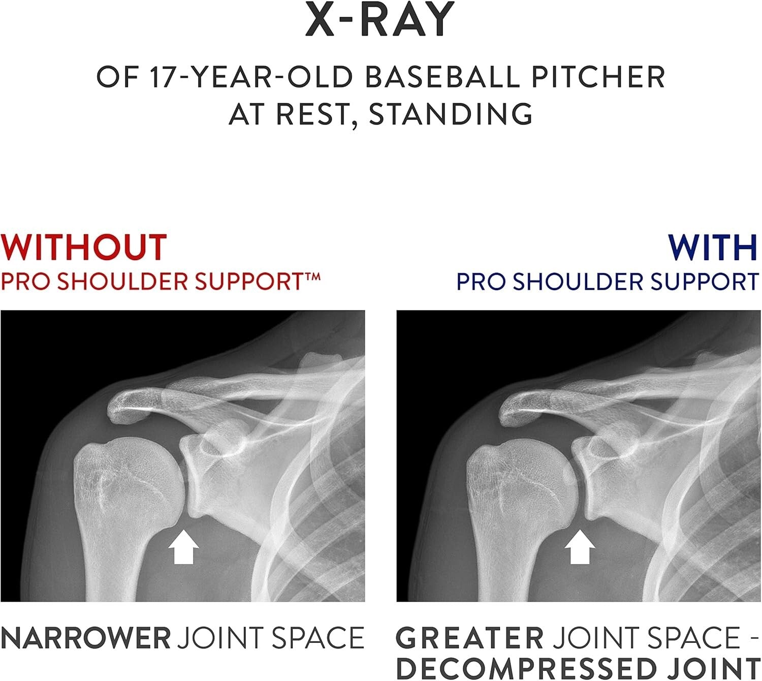 Comfortable Shoulder Support for Post-Surgery Recovery – Ideal for Active Adults