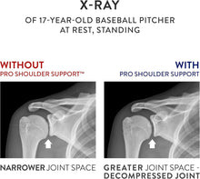 Load image into Gallery viewer, Comfortable Shoulder Support for Post-Surgery Recovery – Ideal for Active Adults