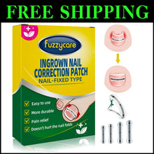 Load image into Gallery viewer, Memory Alloy Ingrown Toenail Corrector - 10 Piece Kit for Effective Home Relief