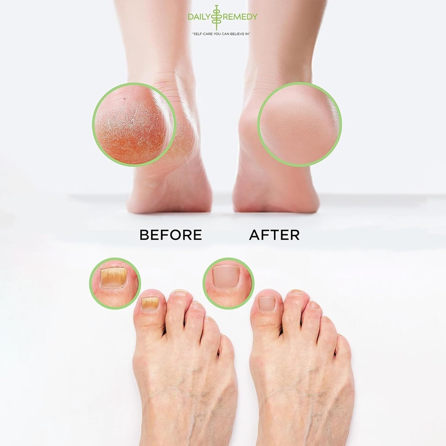 4-Pack Aromatherapy Foot Soaks: Tea Tree, Lavender, Muscle Relief & Citrus