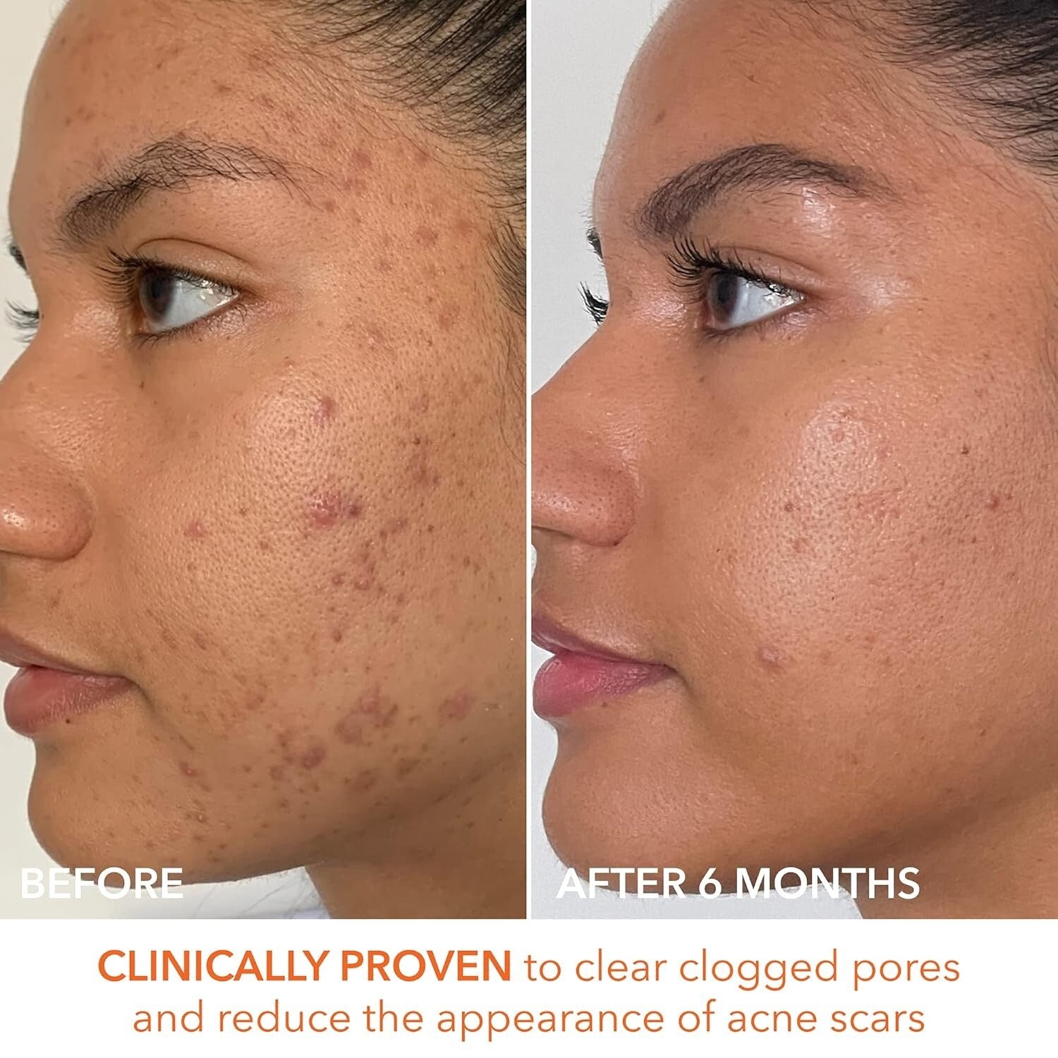 Vegan Daily Peel Pads with AHA/BHA – Smooth Skin & Anti-Aging, 60 Treatments