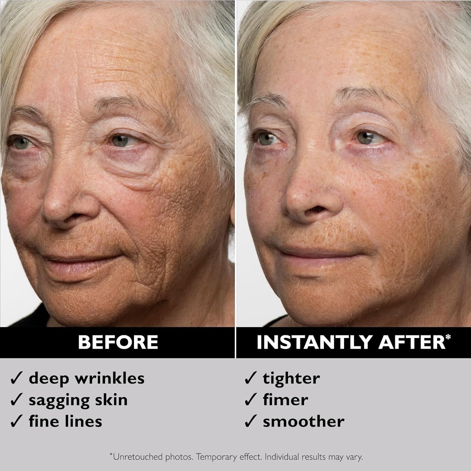 Instant FIRMx Serum - Tighten Fine Lines & Deep Wrinkles, All Skin Types