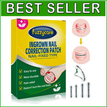 Load image into Gallery viewer, Ingrown Toenail Correction Kit - 10 Titanium Alloy Tools for Fast Pain Relief