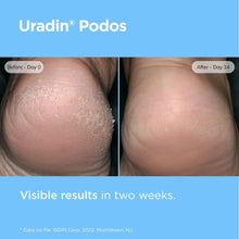 Load image into Gallery viewer, Fast Absorbing Foot Care Cream with Lactic Acid for Dry, Cracked Skin - 75ml