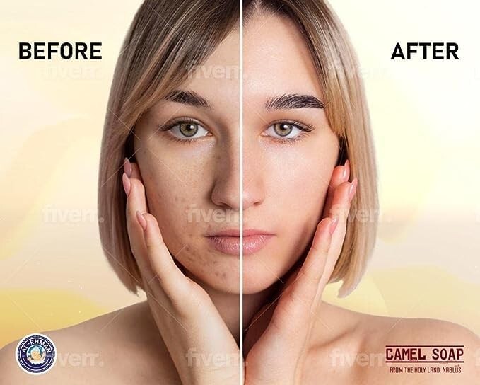 12 Count Organic Virgin Olive Oil Soap Bar from Holy Land - Anti-Aging Treatment