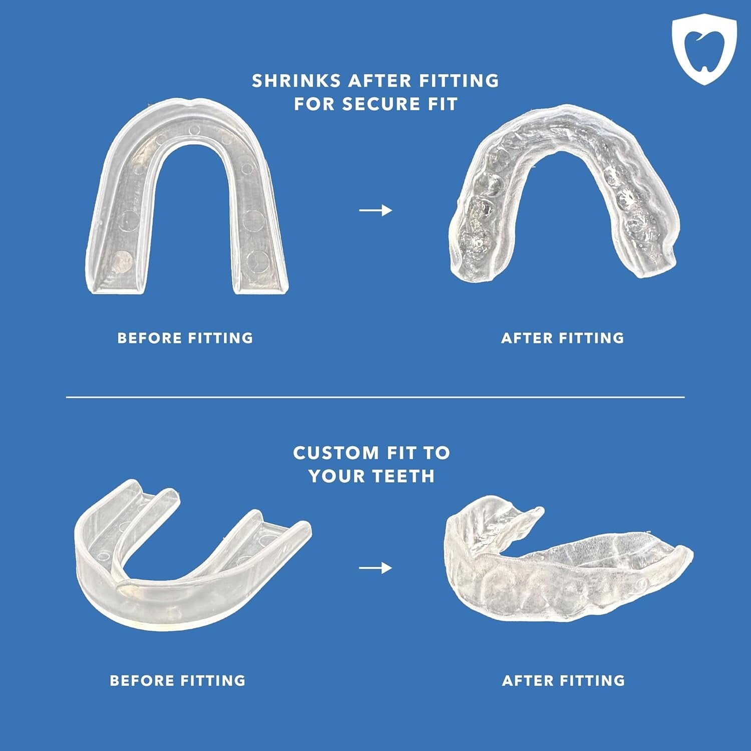 Versatile Zero-Grind Nightguard with Ventilated Case for On-the-Go Protection