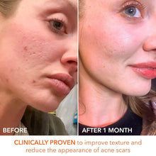 Load image into Gallery viewer, Dr. Dennis Gross Daily Peel: 60 Exfoliating Pads for Radiant Skin &amp; Anti-Aging