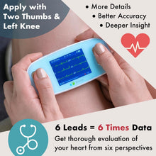 Load image into Gallery viewer, Portable ECG Device - Real-Time Heart Rate Monitor with No Subscription Needed