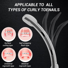 Load image into Gallery viewer, Compact &amp; Effective Ingrown Toenail Treatment - Titanium Alloy Correction Tools