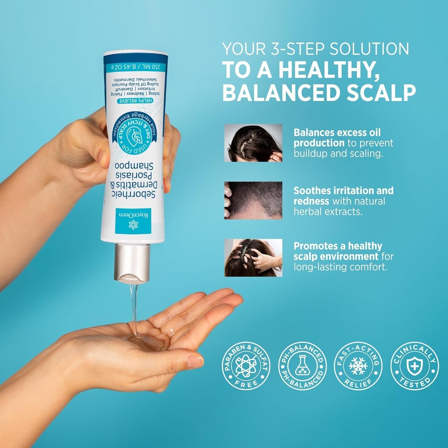 Seborrheic Dermatitis Relief Set - Cream, Shampoo & Conditioner for Scalp Care