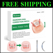 Load image into Gallery viewer, Titanium Alloy Ingrown Toenail Treatment Kit – Patented Nail Correction Tools