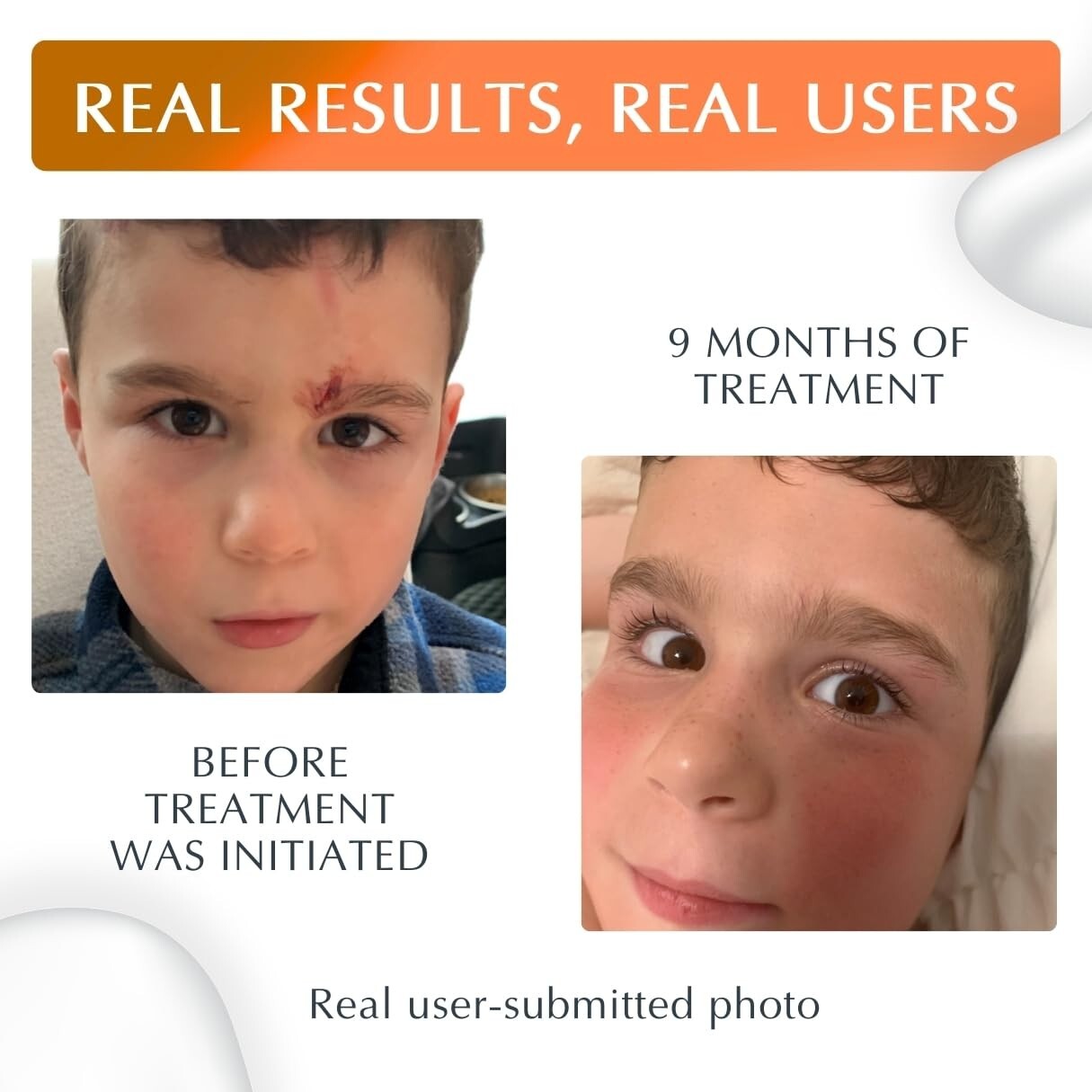 Unscented NewGel Plus UV Scar Gel with Mineral Sunscreen for Total Protection