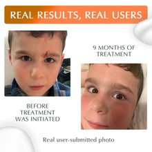 Load image into Gallery viewer, Unscented NewGel Plus UV Scar Gel with Mineral Sunscreen for Total Protection