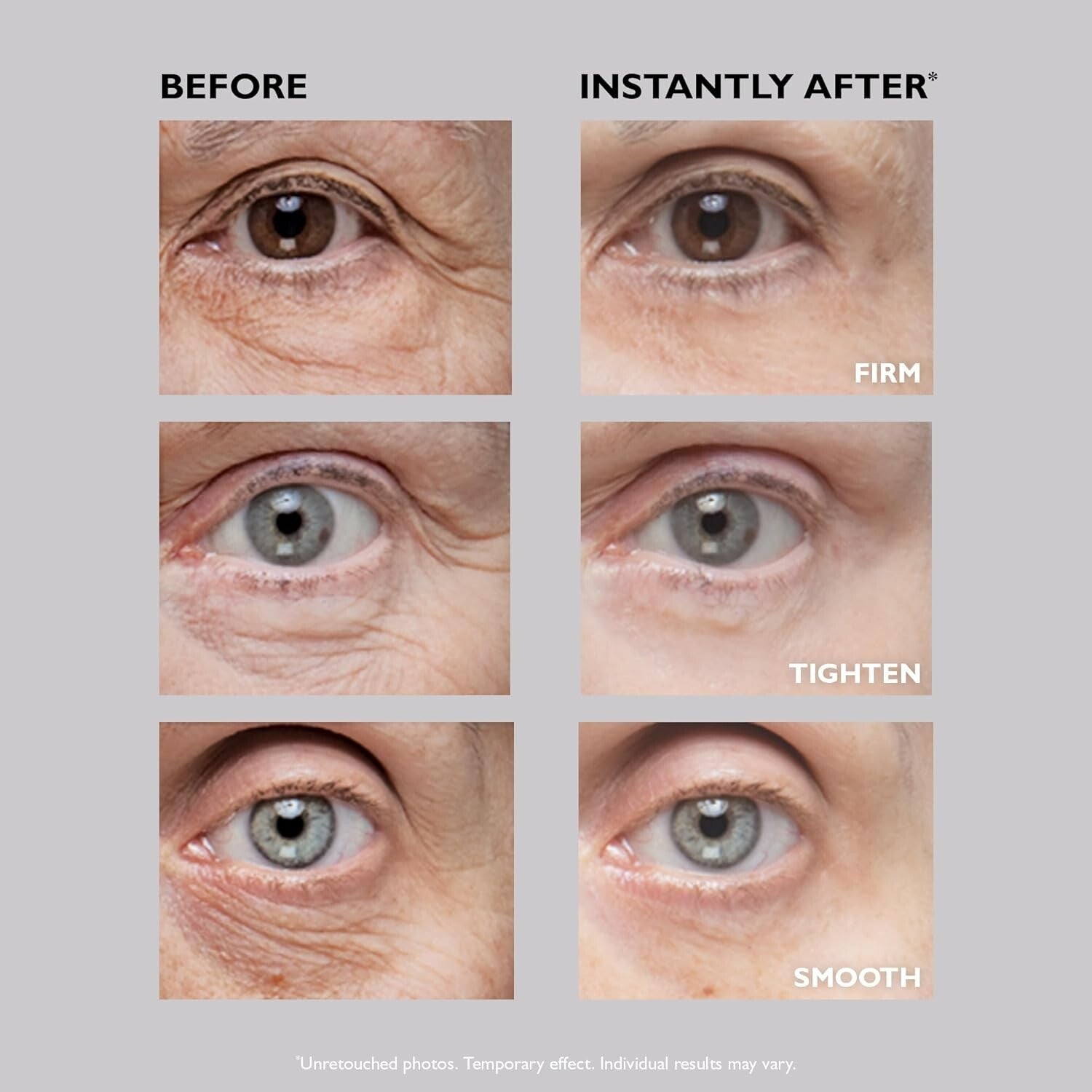 FIRMx Instant Eye Tightener | Effortlessly Reduce Fine Lines (Travel-Friendly)