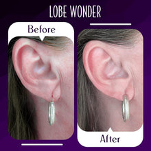 Load image into Gallery viewer, Original Ear Lobe Support Patches - Instant Relief for Stretched Piercings
