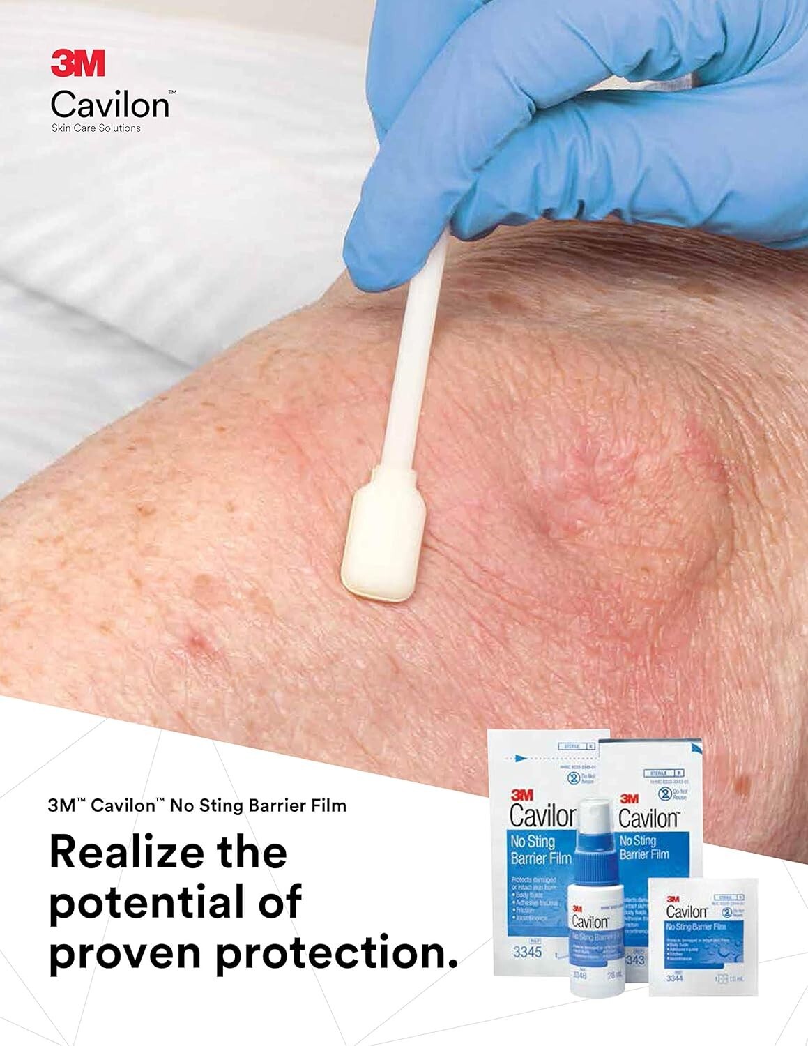 Hypoallergenic No Sting Barrier Film - Clinically Proven Protection Wand Bundle