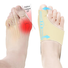 Load image into Gallery viewer, Breathable Bunion Corrector - 2PCS Adjustable Toe Straighteners for Adults