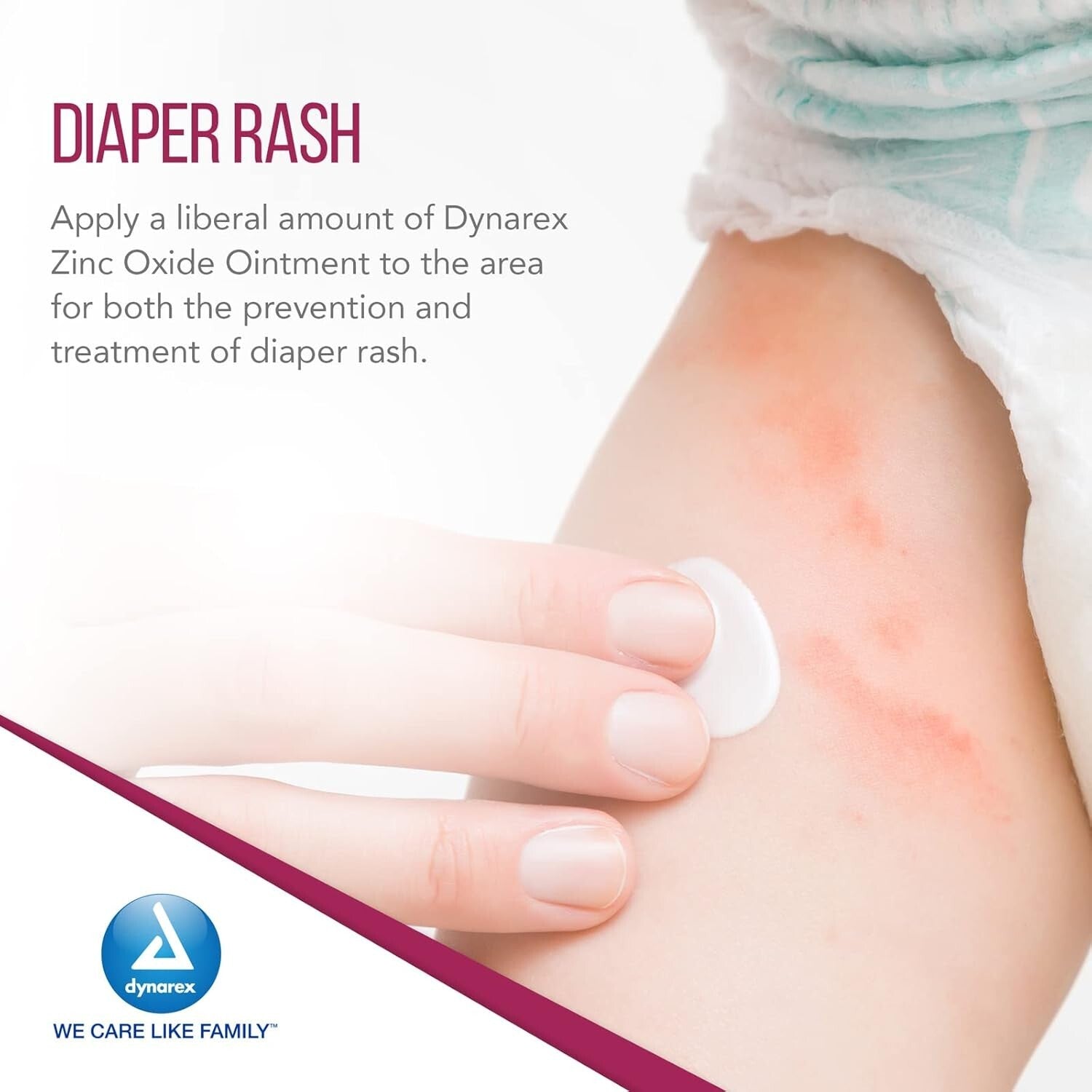 Zinc Oxide Ointment 15 oz Jar, Prevents Diaper Rash, Pack of 12 for Families