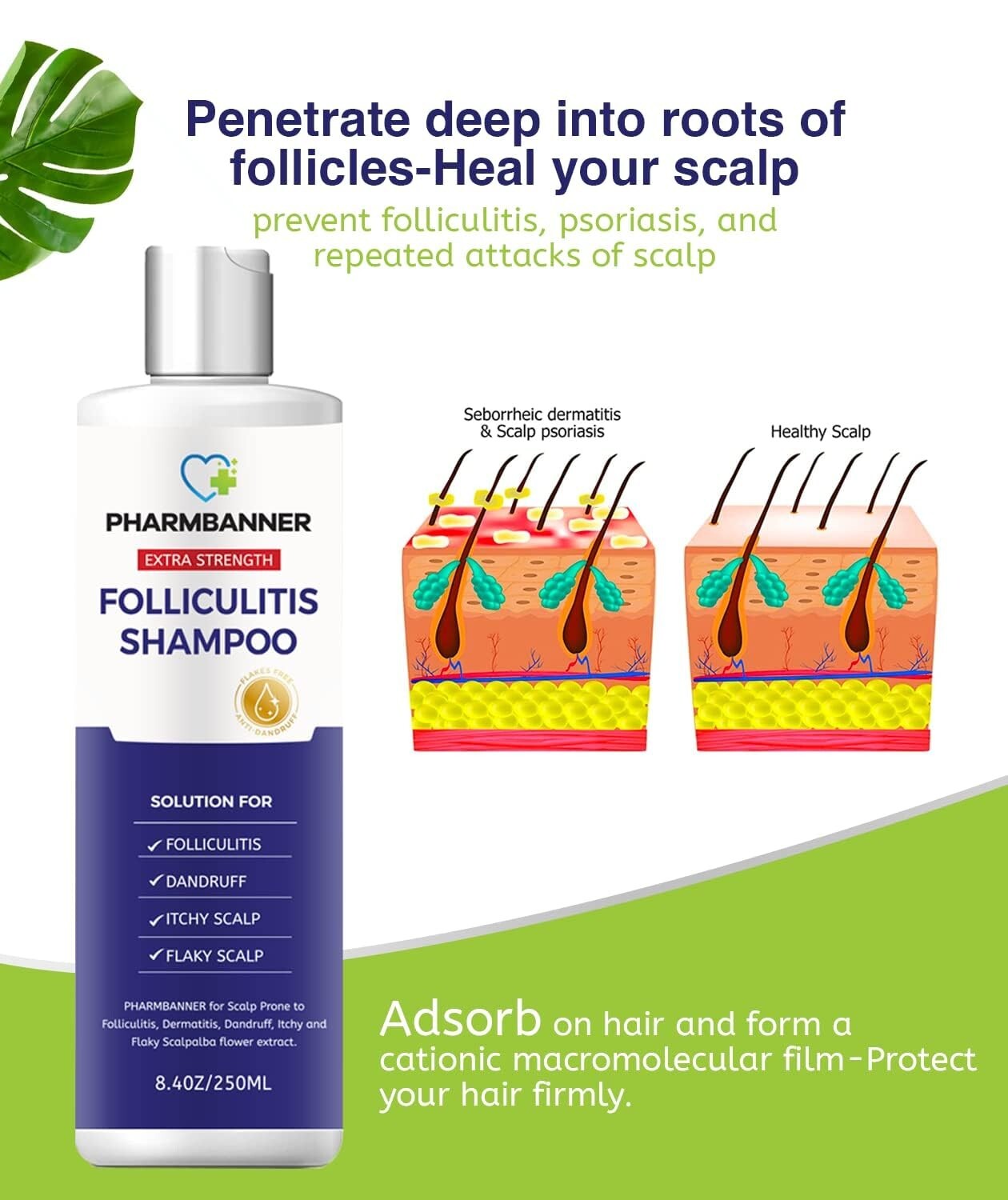 Effective Scalp Treatment Shampoo for Folliculitis & Psoriasis - 16.8 Oz Total