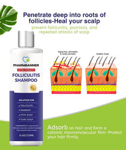 Load image into Gallery viewer, Effective Scalp Treatment Shampoo for Folliculitis &amp; Psoriasis - 16.8 Oz Total